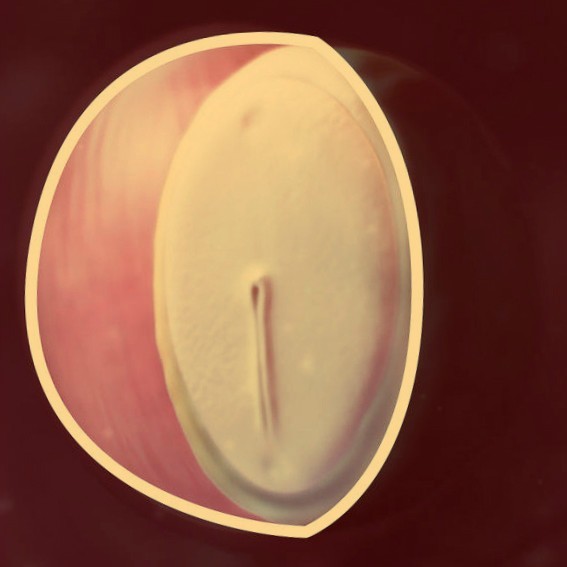 Фотография плода на 4 неделе беременности