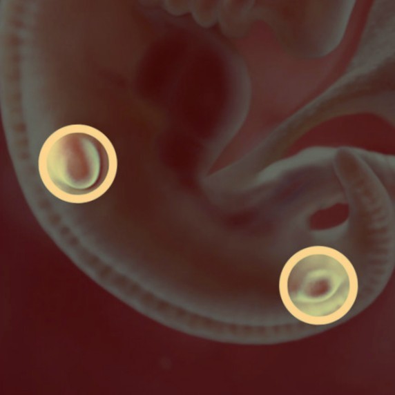 Фото. Плод на 6 неделе беременности