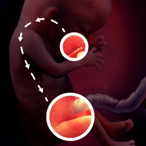 Фото. Плод на 13 неделе беременности