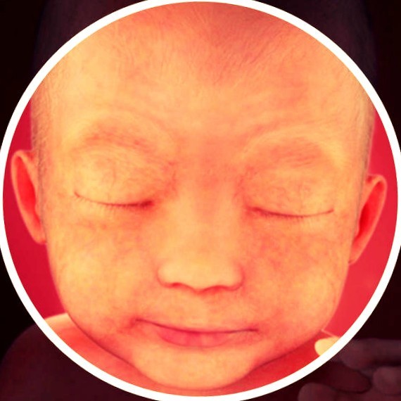 Фото плода на 24 неделе беременности