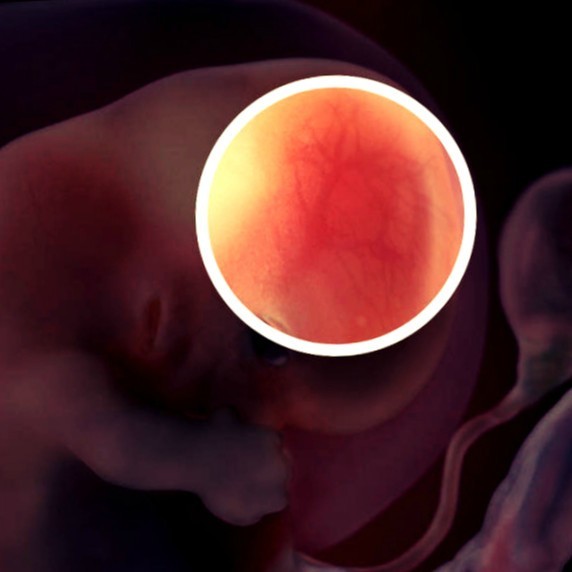 Фото. Плод на 8 неделе беременности