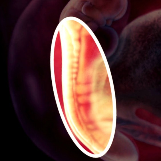 Фото. Плод на 5 неделе беременности