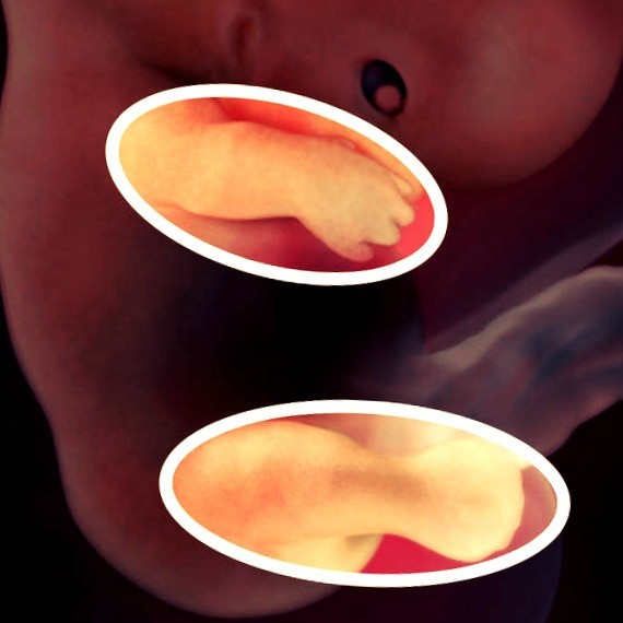 Фото. Плод на 9 неделе беременности