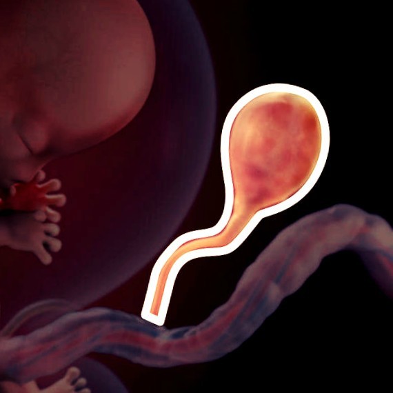 Фото. Плод на 10 неделе беременности